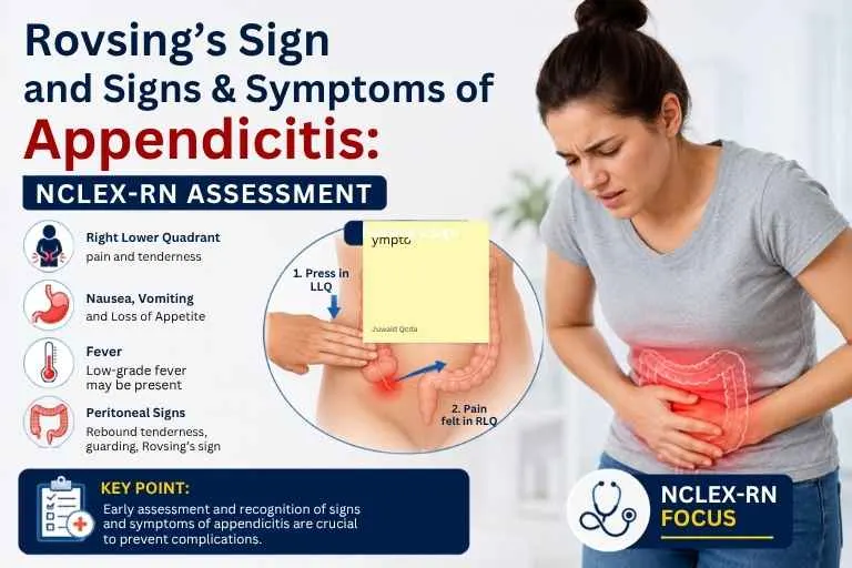 Rovsing’s sign and signs and symptoms of appendicitis for NCLEX-RN assessment, showing right lower quadrant pain, abdominal tenderness, nausea, vomiting, fever, and clinical assessment findings.